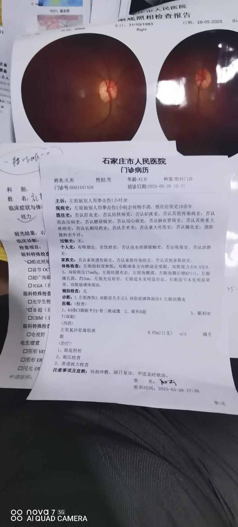 【4地新增死亡病例25例河北石家庄新华区12例_石家庄新华区新冠病例】