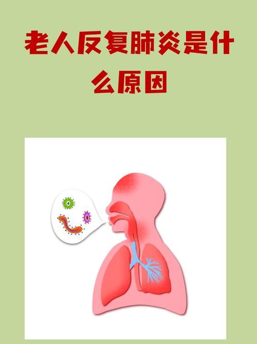 专家:南城县每年或现多个感染高峰:南城有人感染肺炎了吗