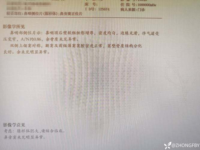 滨江区昨日新增破9_滨江新增病例