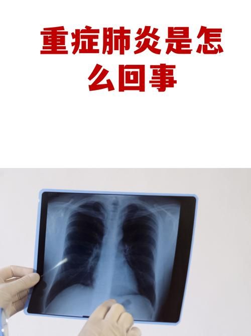 多地新增重症6例河南省商丘市梁园区13例(商丘市新冠状肺炎新增)