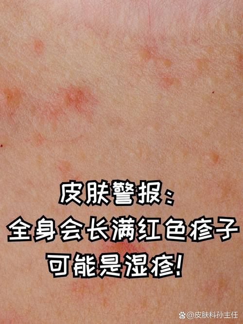 【长宁县新增22例无症状感染者及3例无症状_长宁县新增22例无症状感染者及3例无症状病例】